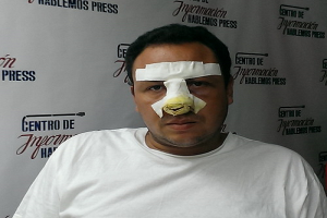 Periodista independiente Roberto de Jesús Guerra luego de la agresión_foto cortesía de Hablemos Press