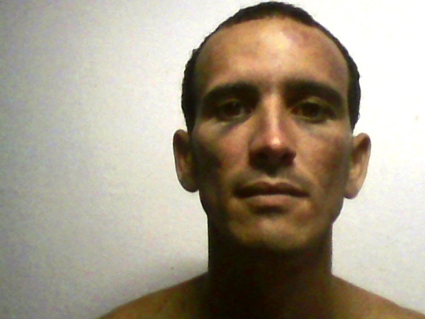 Hematomas en el rostro de Ramón Olivares Abello debido a los golpes recibidos el 10-12-2015 (foto del autor)