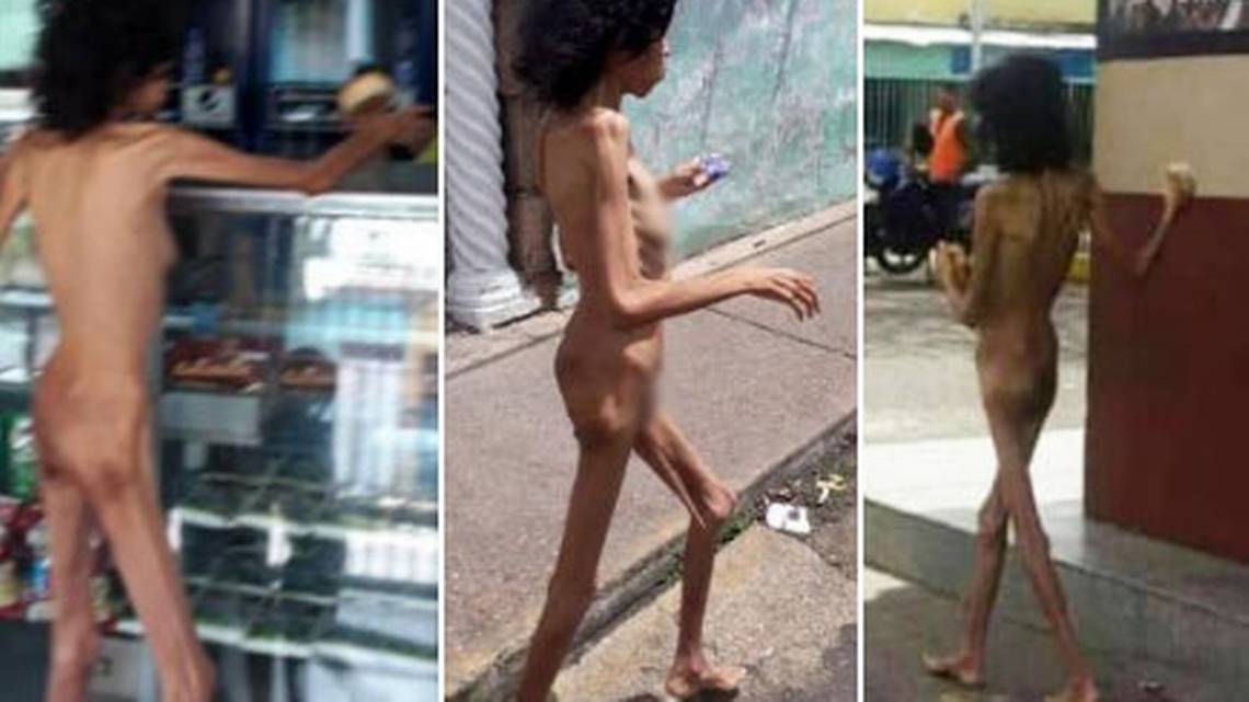 Impactantes imágenes: venezolana desnuda y desnutrida deambula por las call...