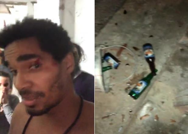 Luis Manuel otero agresion agredido botellas represión movimiento san isidro msi cuba habana cubano cubanos opositores activistas