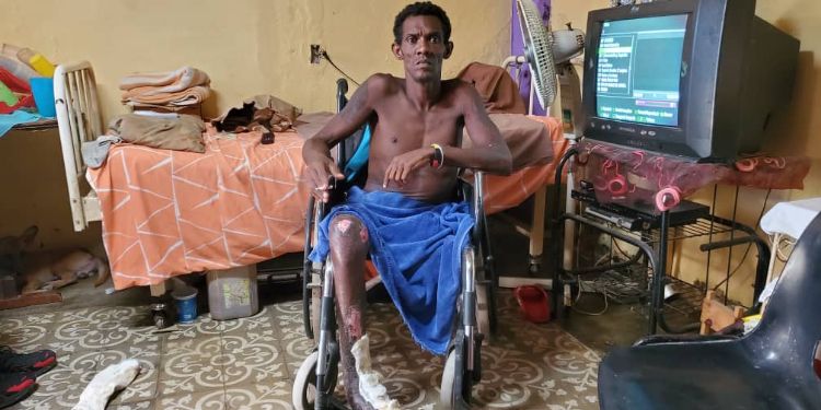 Arístides Rizo Pedroso, cubano, discapacitado